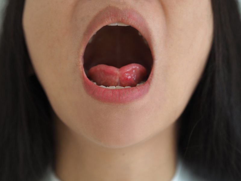 up-close view of a person’s tongue-tie