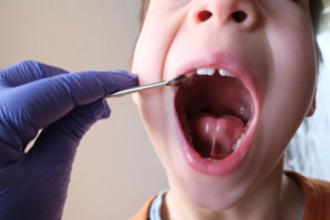 Pediatric dentist inspecting a child’s tongue-tie